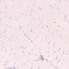 Immunohistochemical staining of human skeletal muscle shows no positivity in myocytes as expected.