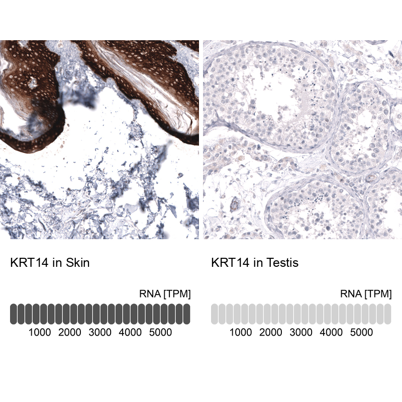 Anti-KRT14 Antibody