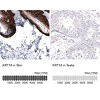 Anti-KRT14 Antibody
