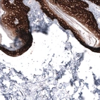 Immunohistochemical staining of human skin shows strong cytoplasmic positivity in squamous epithelial cells.