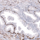 Immunohistochemical staining of human prostate shows strong cytoplasmic positivity in basal layer of glandular cells.