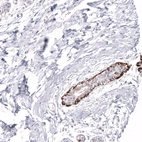 Immunohistochemical staining of human breast shows strong cytoplasmic positivity in basal layer of ductal cells.