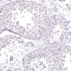 Immunohistochemical staining of human testis shows no positivity in cells in seminiferous ducts as expected.