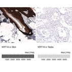 Anti-KRT14 Antibody