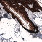 Immunohistochemical staining of human skin shows strong cytoplasmic positivity in squamous epithelial cells.