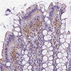 Anti-CD40 Antibody