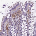 Immunohistochemical staining of human colon shows moderate membranous positivity in lymphoid cells.