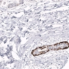 Immunohistochemical staining of human breast shows strong cytoplasmic positivity in basal layer of ductal cells.