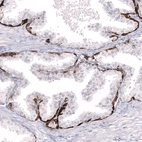 Immunohistochemical staining of human prostate shows strong cytoplasmic positivity in basal layer of glandular cells.