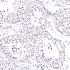 Immunohistochemical staining of human testis shows no positivity in cells in seminiferous ducts as expected.