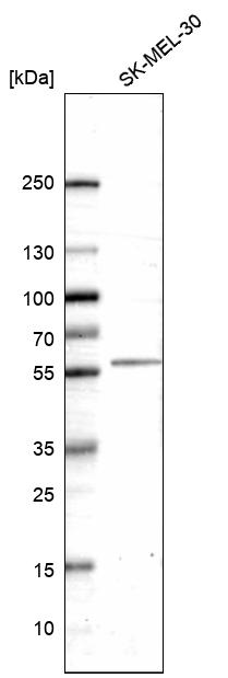 Anti-HTR2B Antibody