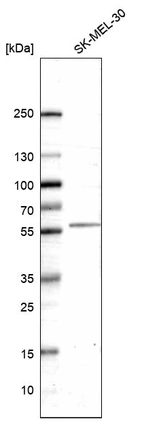 Anti-HTR2B Antibody