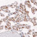 Immunohistochemical staining of human placenta shows strong membranous positivity in endothelial cells.
