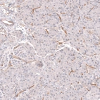 Immunohistochemical staining of human pancreas shows moderate membranous positivity in endothelial cells.