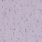 Immunohistochemical staining of human cerebral cortex shows no positivity in neuronal cells as expected.