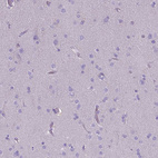 Anti-CD40 Antibody