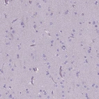 Immunohistochemical staining of human cerebral cortex shows no positivity in neuronal cells as expected.