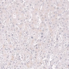 Immunohistochemical staining of human liver shows no positivity in hepatocytes as expected.