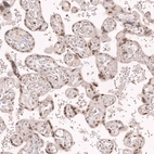Immunohistochemical staining of human placenta shows moderate nuclear positivity in trophoblastic cells.