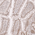 Immunohistochemical staining of human small intestine shows weak nuclear positivity in glandular cells.