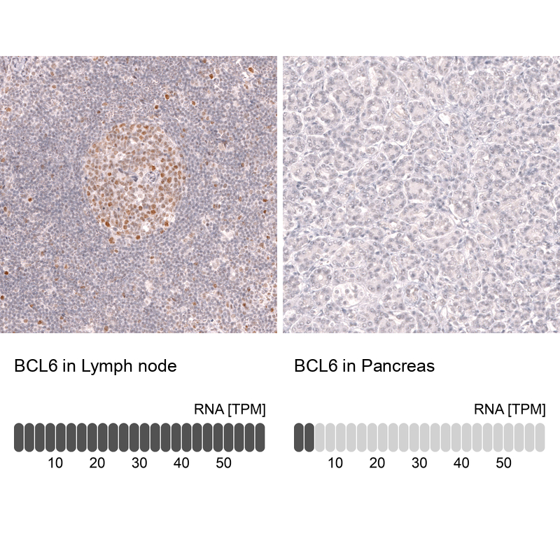 Anti-BCL6 Antibody