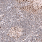 Immunohistochemical staining of human tonsil shows moderate to strong nuclear positivity in germinal center cells.