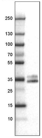Lane 1: Marker [kDa]_br/_Lane 2: Human spleen