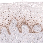 Immunohistochemical staining of human uterine cervix shows strong nuclear positivity in squamous epithelial cells.