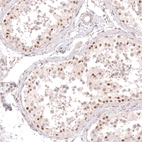 Immunohistochemical staining of human testis shows moderate to strong nuclear positivity in a subset of cells in seminiferous ducts.