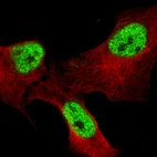 Immunofluorescence staining in A-549 cell line with Anti-BCL6 monoclonal antibody, showing specific staining of nucleoplasm in green. Microtubule- and nuclear probes are visualized in red and blue respectively (where available).
