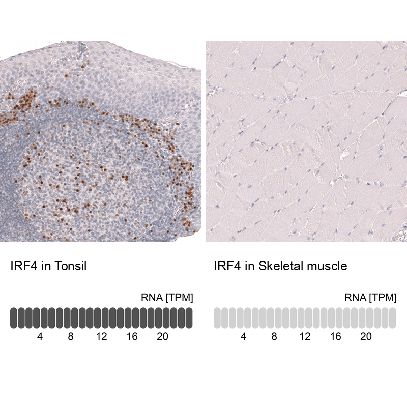 Anti-IRF4 Antibody