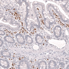 Immunohistochemical staining of human small intestine shows strong nuclear positivity in lymphoid cells.