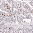 Immunohistochemical staining of human small intestine shows strong nuclear positivity in lymphoid cells.