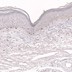 Immunohistochemical staining of human skin shows strong nuclear positivity in a subset of lymphoid cells.