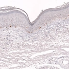 Immunohistochemical staining of human skin shows strong nuclear positivity in a subset of lymphoid cells.