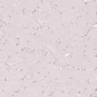 Immunohistochemical staining of human skeletal muscle shows no positivity in myocytes as expected.