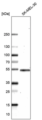 Western blot analysis in human cell line SK-MEL-30.