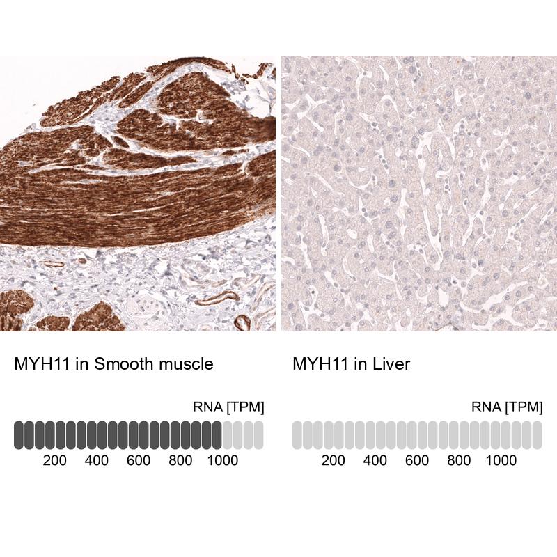 Anti-MYH11 Antibody