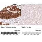 Anti-MYH11 Antibody