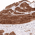 Immunohistochemical staining of human smooth muscle shows strong cytoplasmic positivity in smooth muscle cells.