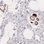 Immunohistochemical staining of human breast shows strong cytoplasmic positivity in myoepithelial cells.