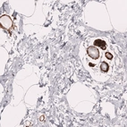 Immunohistochemical staining of human breast shows strong cytoplasmic positivity in myoepithelial cells.