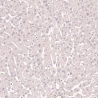 Immunohistochemical staining of human liver shows no positivity in hepatocytes as expected.