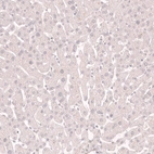 Immunohistochemical staining of human liver shows no positivity in hepatocytes as expected.