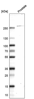 Western blot analysis in human prostate tissue.