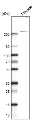 Western blot analysis in human prostate tissue.