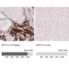 Anti-MYH11 Antibody