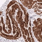 Immunohistochemical staining of human smooth muscle shows strong cytoplasmic positivity in smooth muscle cells.