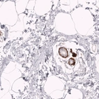 Immunohistochemical staining of human breast shows strong cytoplasmic positivity in myoepithelial cells.