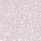 Immunohistochemical staining of human liver shows no positivity in hepatocytes as expected.